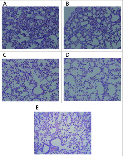 Figure 3. Histopathologic alterations in the lungs of mice. The mice i.p injected with 0.5 mg of rRTA (A), 0.1 mg of rRTA (B), 0.5 mg of mtRTA (C) and 0.1 mg of mtRTA (D). Both (A) and (B) showed the pathological changes, including: epithelial necrosis, partial consolidation and generalized interstitial edema. In addition, the pathological changes in (A) were more severe than that in (B). No obvious pathological changes was found in (C) and (D) as compared to the normal mouse lung histology shown in (E).