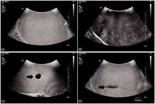 Figure 4. (A) Ultrasound image (5C; IU22; Philips Medical Systems, Bothell, WA) of microbubbles before rupture; (B) ultrasound image of microbubbles after rupture with non-focused ultrasound; (C) ultrasound image of broken microbubbles perpendicular to ultrasound beams with LIFU; (D) ultrasound image of broken microbubbles along the ultrasound beams with LIFU.