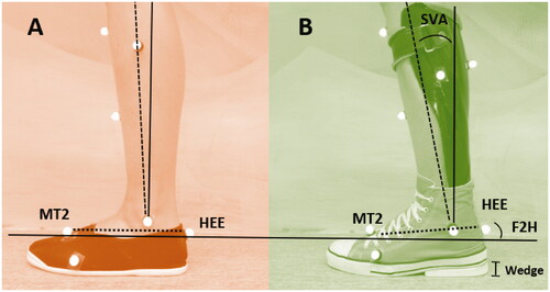 Figure 1. Lower leg/foot markers for (A) NS-SHOES (non-supportive textile shoes) and (B) AFO-footwear combination. Heel height was incremented by placing wedges of 5, 10, and 15 mm below the heel surface of the shoe (indicated with I, (B)). Shank to vertical angle (SVA) was calculated as the orientation of the shank (knee joint centre to ankle joint centre), to the vertical in the sagittal plane. Foot to horizontal angle (F2H) was calculated as the position of the foot (MT2-HEE) to the horizontal in the sagittal plane. Note that markers remained attached to the shoe and AFO for all AFO walking trials.