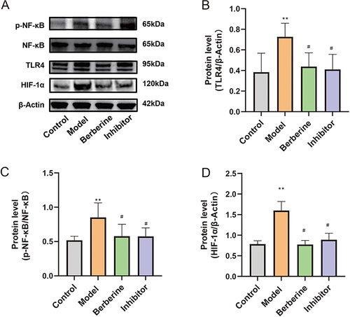 Figure 16 The protein relative expressions of p-NF-κB/NF-κB, TLR4, and HIF-1α in colonic tissues assessed by Western Blot. (A) Representative Western blot images. (B) TLR4. (C) p-NF-κB/NF-κB. (D) HIF-1α. Data are represented as mean ± SD (n= 5). **P<0.01, compared with Control group; #P<0.05, compared with model group.