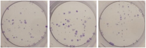 Figure 19. Breast cancer MCF-7 cells alone (Control).