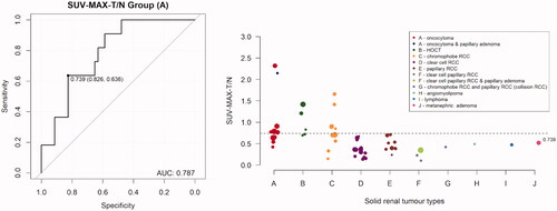 Figure 1. The ratio of relative 99mTc-Sestamibi uptake based on SUVmax measurements on the renal tumour (T) and the non-tumoral renal parenchyma (N). The estimated cut-off value of 0.739 of relative ratio 99mTc-Sestamibi uptake, based on SUVmax measurements of the renal tumour and the non-tumoral parenchyma, resulted in 64% sensitivity and 83% specificity in detecting Renal Oncocytoma (Group A) (AUC: 0.787 [95% CI: 0.644–0.903]). The different colours and sizes of the markers on the right graph represent the different tumour categories and tumour sizes, respectively.