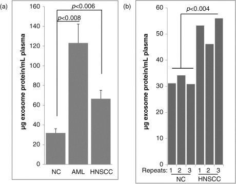 Fig. 4.  A. Comparisons of the protein content in mini-SEC fractions # 4 isolated from plasma of cancer patients or NCs. (a) Exosome protein levels (in µg/mL plasma) in fractions #4 obtained from plasma of AML or HNSCC patients and NCs. Note higher protein levels in in exosome fractions of cancer patients relative to those of NCs. (b) Reproducibility of mini-SEC: plasma specimens (1 mL) obtained from an NC) and a HNSCC patient were repeatedly chromatographed (×3) using different mini-SEC columns. Protein levels measured in #4 fractions of repeated samples are not significantly different. AML=acute myeloid leukaemia; HNSCC=head and neck squamous cell carcinoma; NC =normal control.