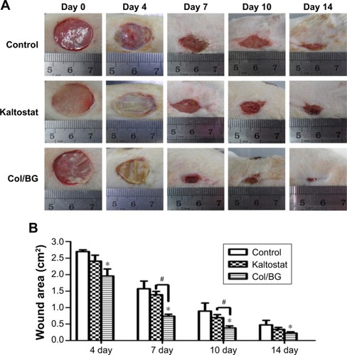 Figure 6 Wound healing in SD rats.Notes: (A) The representative images of skin wounds after treatment with the Col/BG nanofibers or Kaltostat. Untreated wounds were used as controls. (B) Wound areas at different time points after treatment. Data presented as the mean ± StD. *P<0.05 indicates statistically significant difference between the control and Col/BG groups, #P<0.05 indicates a significant difference between Kaltostat and Col/BG groups.Abbreviations: Col/BG, collagen/bioactive glass; SD, Sprague Dawley; StD, standard deviation.