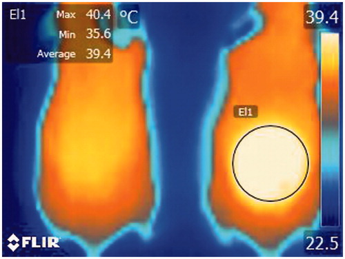 Figure 2. Imaging analysis method of dynamic thermal imaging. The target site was selected by imaging software and the thermal change of the selected region of interest was analysed.