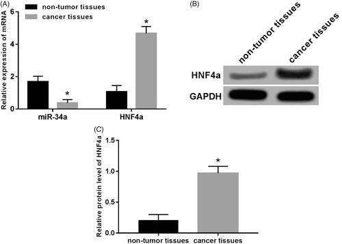 Figure 1. Expression of miR-34a and HNF4α in neuroblastoma tissue. (A) Expression of miR-34a and HNF4α mRNA in human neuroblastoma tissues and normal adjacent tissues; (B) gel electrophoresis of HNF4α protein expression; (C) the expression level of HNF4 proteins in human neuroblastoma and normal adjacent tissues. Note: Compared with the non-tumour tissue group, *p < .05.