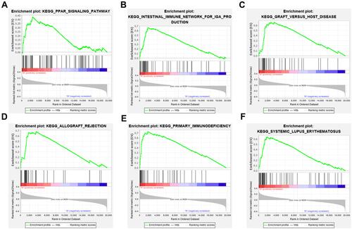 Figure 5 Significantly enriched terms in CSMD3-mutated OC samples from the TCGA cohort identified with GSEA. The enrichment plots display the most enriched terms, including (A) the KEGG terms PPAR signaling pathway, (B) intestinal immune network for IgA production, (C) graft versus host disease, (D) allograft rejection, (E) primary immunodeficiency, and (F) systemic lupus erythematosus, in the CSMD3 mutation group.