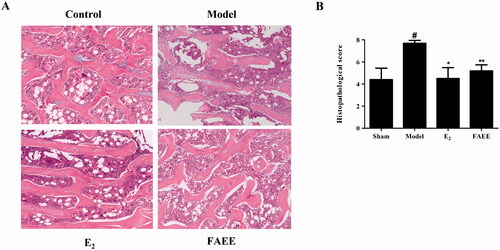 Figure 8. Effect of FAEE treatment on bone histopathology in OVX rats. Haematoxylin and eosin (H&E) staining showing representative images of the right femur (A) and histology scores for the left femur (B) in OVX rats. Data are the mean ± SEM of triplicate experiments. # p < 0.05, versus sham-operated rats, * p < 0.05, ** p < 0.01 versus OVX rats.