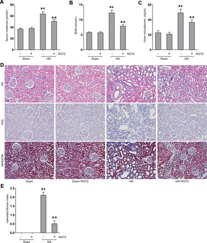 Figure 2 RGTZ improves renal function and alleviates proteinuria and renal damage in HN rats. Levels of (A) serum creatinine, (B) blood urea nitrogen (BUN), and (C) urine microalbumin were examined using biochemical assays. (D) Photomicrographs illustrating hematoxylin–eosin (HE), Masson’s trichrome, and periodic acid-Schiff (PAS) staining of kidney tissue from the different groups (original magnification ×200).(E) Interstitial fibrosis score of kidney tissue from the different groups. RGTZ, rosiglitazone. Data are represented as the mean ± SEM. *p < 0.05 vs sham group; #p< 0.05 vs sham + RGTZ group. **p < 0.05 vs HN group.