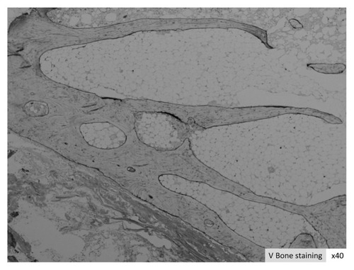 Figure 2 MMA resin-embedded V bone stain.