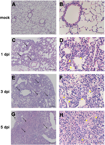 Fig. 2 Histopathology of the lungs from H5N6/GZ14-infected mice.a, b Eight-week-old female BALB/c mice without infection. c–h Eight-week-old female BALB/c mice infected with 10 MLD50 (50 pfu) of H5N6/GZ14. Lung tissue sections were stained with hematoxylin-eosin and analyzed under a light microscope. At 1 dpi, inflammatory cells (arrows) could be observed around the bronchi (c, d). The airways showed small volumes of exudates with edema fluid mixed with erythrocytes and inflammatory cells (asterisks). e, f At 3f dpi, the lungs had high numbers of inflammatory cells (arrows), bronchial epithelial intracellular edema, and necrosis with necrotic epithelium sloughing into the airway spaces (asterisks). g, h At 5 dpi, severe pulmonary parenchyma consolidation was observed. Increased accumulation of inflammatory cells and necrotic tissue debris (arrows) was observed in the lung parenchyma. The alveoli were completely filled with edema and hemorrhages (asterisks). Scale bars = 100 μm (a, c, e, g) and 25 μm (b, d, f, h)