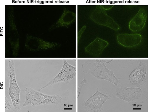 Figure 5 Photothermally triggered drug release from CTD-TSL@GNPs in A431 cells.Note: The fluorescence signal of FITC encapsulated in CTD-TSL@GNPs before and after 20 min irradiation with an NIR laser, at a power density of 200 mW//cm2.Abbreviations: CTD, cantharidin; CTD-TSL@GNPs, CTD-encapsulated TSLs coated with GNPs; DIC, differential interference contrast; FITC, fluorescein isothiocyanate; GNPs, gold nanoparticles; NIR, near-infrared; TSL, thermal-sensitive liposome.