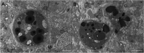 Figure 2. TEM images of intact and digested zooxanthellae in Berghia stephanieae. The large black structures inside these zooxanthellae are lipid droplets, made electron dense via OsO4 staining after fixation. (A) An intact zooxanthella located in Berghia stephanieae digestive cells. (B) Two partially degraded zooxanthellae in the same tissue.
