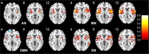 Figure 3 The positive modulatory effects are showed in warm color, and this diagram exhibits the insular gyrus effect of AN, MN, DMN, SN in a transverse view.