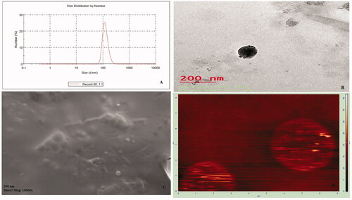 Figure 5. (A–D) Images of SIT-NPopt: (A) Particle size distribution image; (B) Transmission electron micrograph; (C) Scanning electron micrograph; (D) Atomic force microscopy.