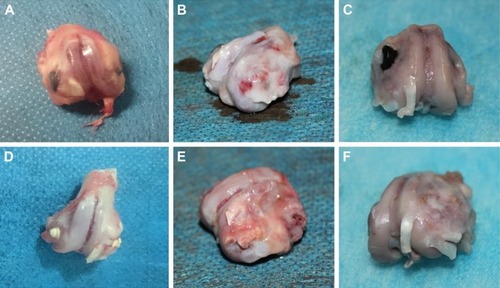 Figure 4 The specimen of harvested distal femoral condyles at 4 (A), 8 (B), and 12 (C) weeks after surgery in the control group; the specimen of harvested distal femoral condyles at 4 (D), 8 (E), and 12 (F) weeks after surgery in the experimental group.