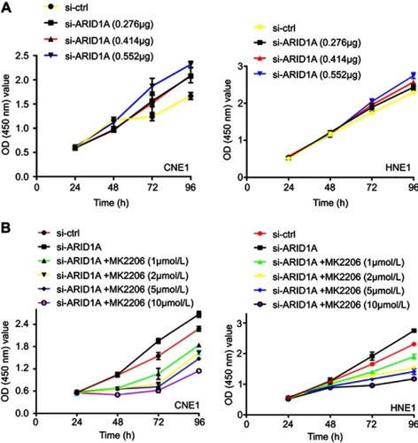 Figure S1 The effects of different concentration of siRNA and MK2206 on cell growth of NPC cells.