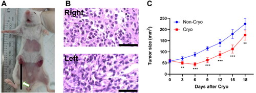 Figure 1. Cryo produced transient growth inhibition of distant tumors outside the ablation zone. A. The mouse bilateral in situ mammary tumor model was successfully constructed, and the white arrow indicates that the mouse right mammary tumor was treated with Cryo. B. The tumor tissue from the successful model was stained with H&E, and a large number of tumor cells are visible in the field of view. Bars, 50 μm. C. Growth curve of the left unablated tumor. (n = 10).