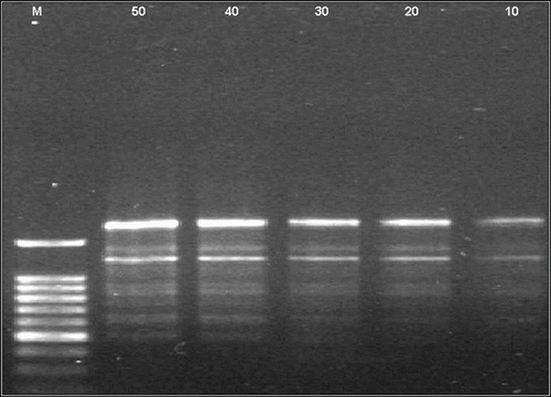 Fig. 2 Optimisation de la quantité d’ADN en PCR. M: Marqueur 100 pb, 1-5 correspondent respectivement à 50; 40; 30; 20 et 10 ng d’ADN. Fig. 2. DNA quantity optimization for PCR. M: 100 pb marker; 1-5 represent 50, 40, 30, 20 and 10 ng of DNA respectively.