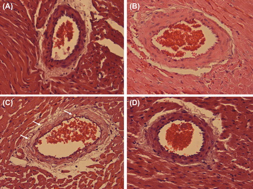 Figure 1. Representative histology of a remote intramyocardial artery of a normal heart (A), a graft with ischemia-reperfusion injury only (IRI; B), a graft with ischemia-reperfusion injury and myocardial infarction (IRI + MI; C), and a graft with ischemia-reperfusion injury and myocardial infarction treated with Sildenafil (IRI + MI + S; D) 2 days after reperfusion simulating resuscitation. X40. Note edema of intramyocardial artery shown as vacuolization of vessel wall in C (small arrows).