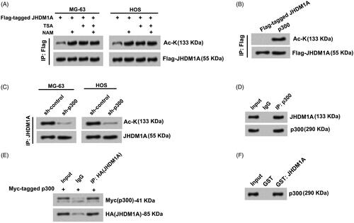 Figure 1. JHDM1A was acetylated by p300 in osteosarcoma cells. (A) MG-63 and HOS cells were transfected with plasmids expressing Flag-tagged JHDM1A, respectively. Immunoprecipitation (IP) assay with anti-Flag antibody and immunoblotting assay with pan-acetyl-lysine (Ac-K) antibody showed that JHDM1A could be acetylated in osteosarcoma MG-63 and HOS cells. TSA and NAM further promoted the acetylation of JHDM1A. (B) p300 and Flag-JHDM1A were co-transfected into HEK293 cells. IP assay with anti-Flag antibody and immunoblotting assay with Ac-K antibody showed that p300 induced JHDM1A acetylation. (C) sh-p300 was transfected into MG-63 and HOS cells. IP assay with anti-Flag antibody and immunoblotting assay with Ac-K antibody showed that knockdown of p300 reduced the acetylation of JHDM1A. (D) IP assay was carried out in HOS cell lysates using antibody against p300. Western blotting using JHDM1A antibody showed that JHDM1A also existed in the complex. (E) HA-tagged JHDM1A and Myc-tagged p300 were co-transfected into MG-63 cells. IP assay was carried out in MG-63 cell lysates using antibody against HA. Western blotting using anti-Myc antibody and anti-HA showed that p300 also existed in the complex. (F) Glutathione S-transferase (GST) pull down assay with GST-tagged JHDM1A and p300 showed that p300 directly interacted with JHDM1A.