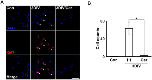 Figure 3. Inhibition of TRPM7 prevents Schwann cell proliferation in ex vivo sciatic nerves. (A) Sciatic nerve fibers were immunostained with anti-Ki67 (a marker for proliferation, red) and 4′,6-diamino-2-phenylindole (DAPI, blue). Scale bar = 50 μm. (B) Cell counts were the number of Ki67/DAPI double-positive cells (n = 3).