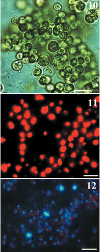 Figs 10–12. Light and epifluorescent microscopic pictures of the symbiotic microalgae isolated from primmorphs of L. baicalensis and cultivated in natural Baikal water. 10. Cells viewed with bright field optics. 11. Epifluorescence microscopy, showing chloroplast autofluorescence. 12. DAPI staining, showing microalgae cells containing chloroplasts and nuclei (blue). Scale bars: 10 µm.