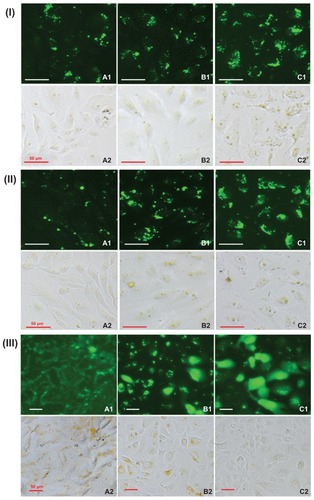 Figure 7 Typical fluorescence images of (I) hRPE cells incubated with FITC/DA-Chit nanoparticles for 24 hours at concentrations of (A) 0.3 mg/mL, (B) 0.5 mg/mL, and (C) 1.0 mg/mL; (II) hRPE cells incubated with FITC/DA-Chit nanoparticles at 1.0 mg/mL for (A) 3 hours, (B) 6 hours, and (C) 24 hours. (III) hRPE cells further incubated for different times following removal of FITC/DA-Chit nanoparticles from the culture medium, ie, (A) one day, (B) 3 days, and (C) 5 days, after incubation with 1.0 mg/mL of FITC/DA-Chit nanoparticles for 24 hours (scale bar 50 μm, 1 fluorescence field images, 2 bright field images).Abbreviations: hRPE, human retinal pigment epithelial; FITC/DA-Chit, fluorescein isothiocyanate-labeled deoxycholic acid-modified chitosan.