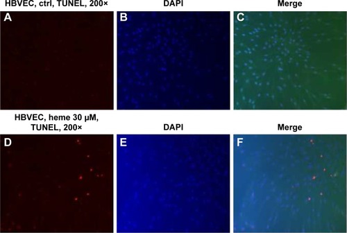 Figure 1 HBVECs were treated with 30 μM of heme for 24 h followed by evaluation of cell apoptosis TUNEL assay.