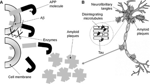 Figure 1 Formation of amyloid plaques (A) and neurofibrillary tangles (B) in the neurons in Alzheimer’s disease.Abbreviations: Aβ, β-amyloid; APP, amyloid precursor protein.