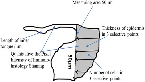 Figure 2. A schematic diagram showing human wound healing biopsy measurements for determining the length of the new epithelial tongue, number of keratinocytes, and thickness of epidermis in wounded skin.