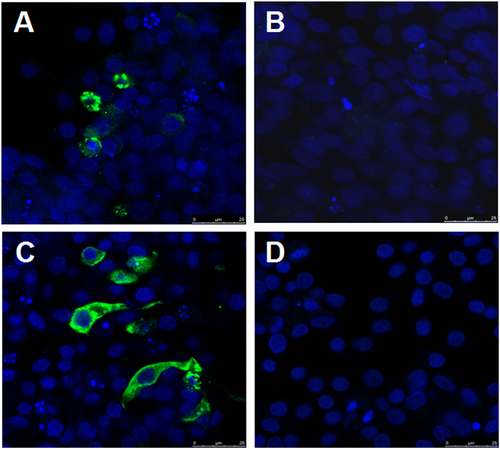 Fig. 3 Identification of the novel goose astrovirus GD isolate in LMH cells by indirect immunofluorescence assay.a, b LMH cells infected with or without GD were reacted with the convalescent sera from the survival geese with gout symptomrespectively. c, d LMH cells infected with or without GD were reacted with the mouse sera against capsid P2 of GD respectively