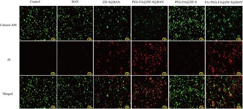 Figure 5 Fluorescence microscopy images using different samples treated with 40 μg/mL of BAN, all images on a scale of 5 μm.