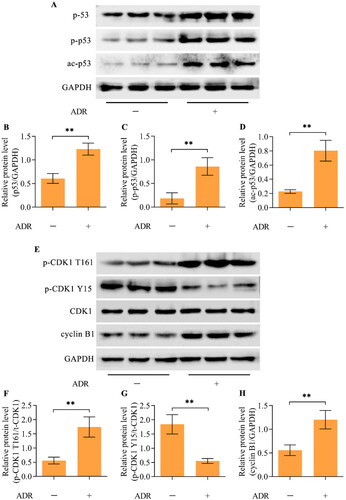 Figure 2. ADR promoted hyperactivation of p53 and the CDK1/cyclin B1 axis in podocytes. (A-D) The levels of p53, p-p53 (Ser15), and ac-p53 (Lys379) in ADR-treated podocytes were measured via Western blotting. (E-H) The total CDK1 (t-CDK1), p-CDK1 (T161), p-CDK1 (Y15) and cyclin B1 levels in ADR-treated podocytes were detected via Western blotting. n = 3, **p < 0.01.