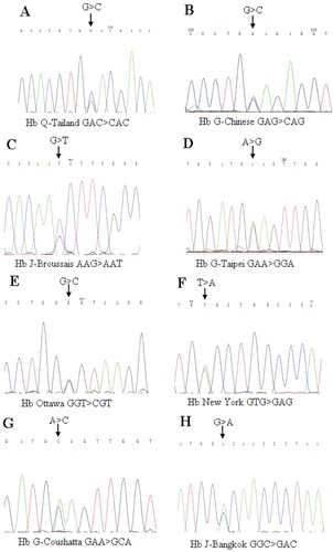 Figure 1. Sequencing results of eight kinds of hemoglobin variants. The mutation sites were indicated by arrows. A: Hb Q-Thailand (HBA1:c.223G > C); B: Hb G-Chinese (HBA2:c.91G > C); C: Hb J-Broussais (HBA2:c.273G > T); D: Hb G-Taipei (HBB:c.68A > G); E: Hb Ottawa (HBA1:c.46G > C); F: Hb New York (HBB:c.341T > A); G: Hb G-Coushatta (HBB:c.68A > C); H: Hb J-Bangkok (HBB:c.170G > A).