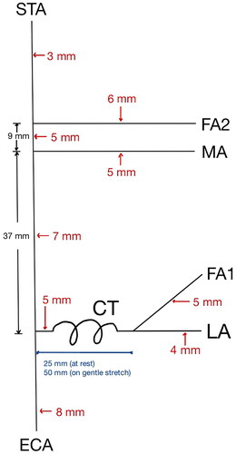 Figure 4. Measurements: FA1, MA, FA2, and STA branch from ECA. The diameter of ECA is 8 mm proximally, 7 mm after FA1 takeoff, and 5 mm after MA takeoff. As ECA terminates as STA, the diameter is 3 mm. The diameters of FA1, MA, and FA2 are 3, 5, and 6 mm, respectively. The distance between the takeoffs of FA1 and MA is 37 mm, and the distance between the takeoffs of MA and FA2 is 9 mm.