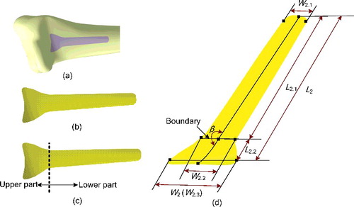 Figure 3. Construction and parameterization of abutted surface of volar plate. (a) Region-of-interest marked on bony surface of the 3D reconstruction model of distal radius. (b) Source surface separated from the bony surface. (c) Abutted surface. (d) Parametric abutted surface.