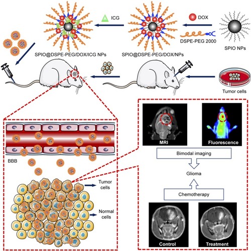 Figure 1 Schematic illustration. SPIO@DSPE-PEG/DOX/ICG NPs preparation procedure and MR/NIR fluorescence dual-modal imaging and chemotherapy of glioma through intravenous injection.Abbreviations: BBB, blood–brain barrier; DOX, doxorubicin; DSPE-PEG, 1,2-distearoyl-sn-glycero-3-phosphoethanolamine-N-[methoxy(polyethylene glycol)]; ICG, indocyanine green; MR, magnetic resonance; SPIO NPs, superparamagnetic iron oxide nanoparticles; NIR, near-infrared.