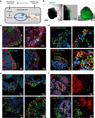 Figure 2. Distribution of Toxoplasma gondii in the human cerebral organoids. (A) Schematic representation of the life cycle of T. gondii. (B) 3D images of a cerebral organoid infected with T. gondii (green). (C – F) Representative fluorescence images of cerebral organoids infected with 2 strains of T. gondii: ME49 (top) and RH (bottom) infected cerebral organoids are shown stained for (C) TUJ1, a neuronal marker; (D) GFAP, an astrocyte marker; (E) O1, an oligodendrocyte marker; and (F) SOX2, a radial glial cell marker. Scale bars, as indicated.