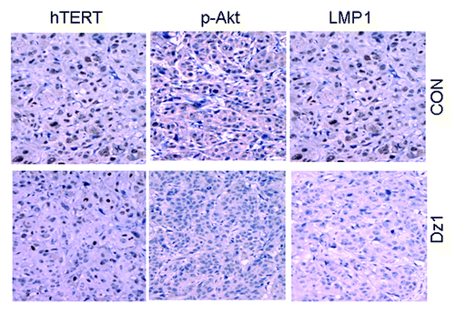 Figure 5. LMP1 is associated with the expression of phosphorylated Akt and hTERT in vivo. Immunohistochemical staining was performed for LMP1, phosphorylated Akt and hTERT in Dz1- or CON-treated NPC tumors of Athymic Balb/c mice. Data were derived from 10 xenograft tumors in 2 groups (200×).