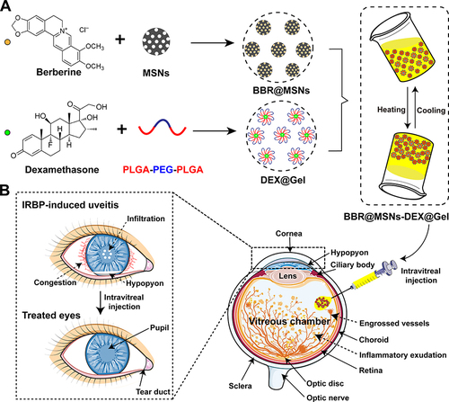 Scheme 1 Schematic representations of preparation procedure (A) and intravitreal administration (B) of the dual-drug nanocomposite formulation with berberine and dexamethasone (BBR@MSN-DEX@Gel) for sustained and combined therapy on experimental autoimmune uveitis (EAU) induced by IRBP peptide.