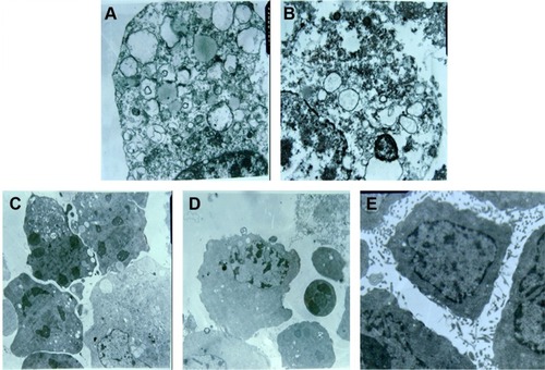 Figure 7 TEM examination of HECs treated with indicated agents. (A and B) Sodium morrhuate group (×10,000); (C) liposomal sodium morrhuate group (×4,000); (D) sodium morrhuate immunoliposome group (×4,000); (E) control group (×4,000).Abbreviations: HEC, hemangioma endothelial cell; TEM, transmission electron microscopy.
