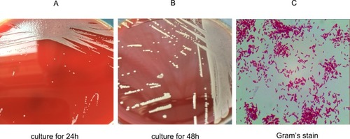 Figure 1 Morphology and Gram’s staining of P. sputorum. Culture blood samples were transferred to Columbia blood plates and incubated in the 5% CO2 incubator at 37°C for (A) 24 h and (B) 48 h. Gram’s staining showed that P. sputorum is (C) a gram-negative bacilli.
