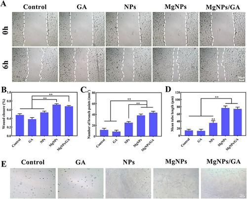 Figure 5 In vitro assessment of angiogenesis. (A and B) Cell migration assay and quantitative analysis, scale bar: 50µm. (C) Branch point quantitative analysis of tube formation. (D) Mean tube length quantitative analysis of tube formation. (E) Images of tube formation of HUVECs after 12 h treatment with each groups, scale bar: 50µm. Results are presented as mean ± SD (N = 3), **P < 0.01.