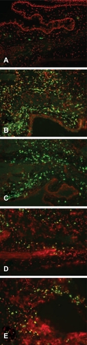 Figure 2 Eosinophil infiltration of conjunctiva. Confocal images of tissue sections from each treatment group stained for eosinophil-specific major basic protein (green) and counterstained with propidium iodide (red). A) No sensitization, no challenge (NS/NC; naïve animals); B) Sensitized, challenged (S/C); C) S/C + drug vehicle; D) S/C + 0.1% topical olopatadine; E) S/C + 0.025% topical alcaftadine. Major basic protein staining is most pronounced in sensitized, challenged animals without drug treatment (B and C).