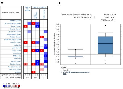 Figure 1 The expression pattern of KIF1A in different types of tumors. (A) The number of data sets presented in this graph belongs to the over-expression (red) or down-expression (blue) of target genes (cancer and normal tissues), which is of statistical significance. The number in each cell is equal to the number of analyses that satisfy these thresholds in the cancer type. Of all genes measured in each study, the rank of the gene was linked to the percentage of the target gene. Cell color depends on the percentile of optimal gene sequencing for intracellular analysis. (B) The box plot is derived from gene expression data in Oncomine, showing different expression of KIF1A in normal tissues and OC tissues.