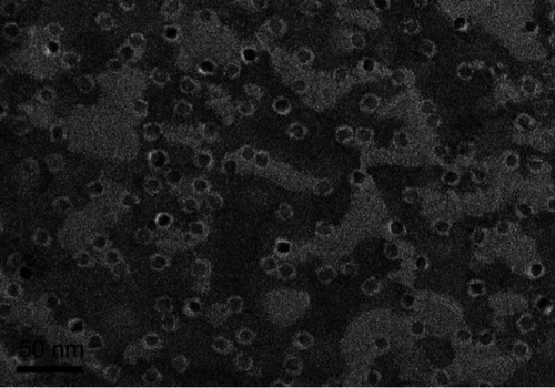 Figure 1 Negatively stained transmission electron microscopy (TEM) of the ultrasmall superparamagnetic iron oxide (USPIO)–polyethylene glycol (PEG)–Sialyl Lewis X (sLex) nanoparticles. The nanoparticles are well separated by the PEG shell.