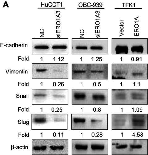 Figure 7 Correlation between ERO1A and EMT progression. (A) Relative expression level of E-cadherin was upregulated, While expression of Vimentin, Snail, Slug, was significantly downregulated in HuCCT1 and QBC939 cells. However, the results in TFK1 cells were the opposite.Abbreviation: NC, negative control.