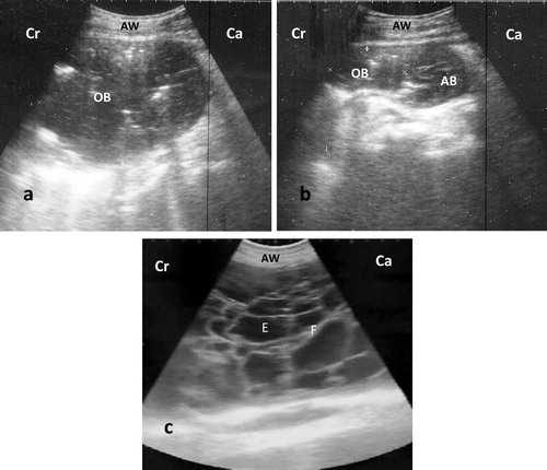 Figure 1. Ultrasonography of ventral abdomen with 3.5 MHz convex probe show: (a) anechoic content with echoic stippling and surrounded by echogenic wall (OB), (b) same structure after aspiration; notice the appearance of abomasum (AB) after reduction of bursal size, (c) peritonitis appears as echogenic brands (F: fibrin) interspersed with anechoic fluid (E: exudate). AW: abdominal wall, Cr: cranial, Ca: caudal.