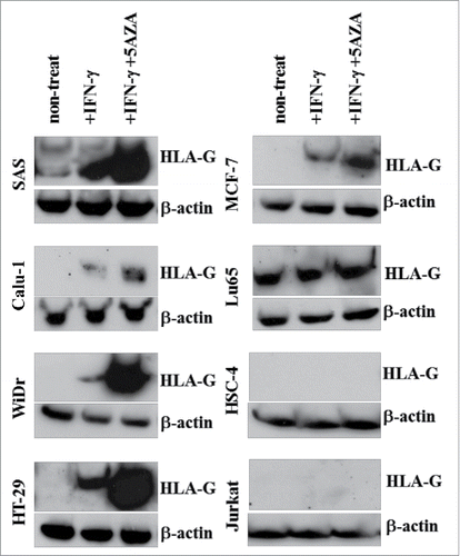 Figure 3. Evaluation of HLA-G expression in tumor cell lines after treatment with IFNγ and 5-AZA. HLA-G expression in the tumor cell lines was evaluated by Western blotting. These tumor cell lines were treated with or without IFNγ alone or in combination with 5-AZA for 72 h before tested.